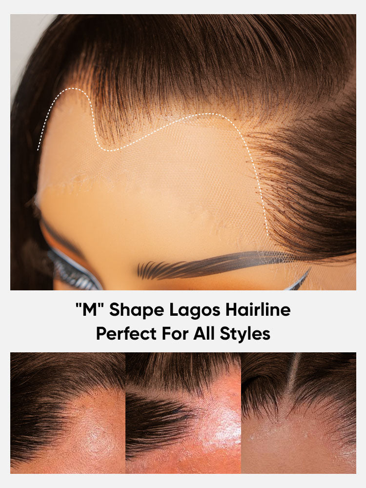 M shape lagos hairline