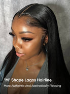 M shape lagos hairline