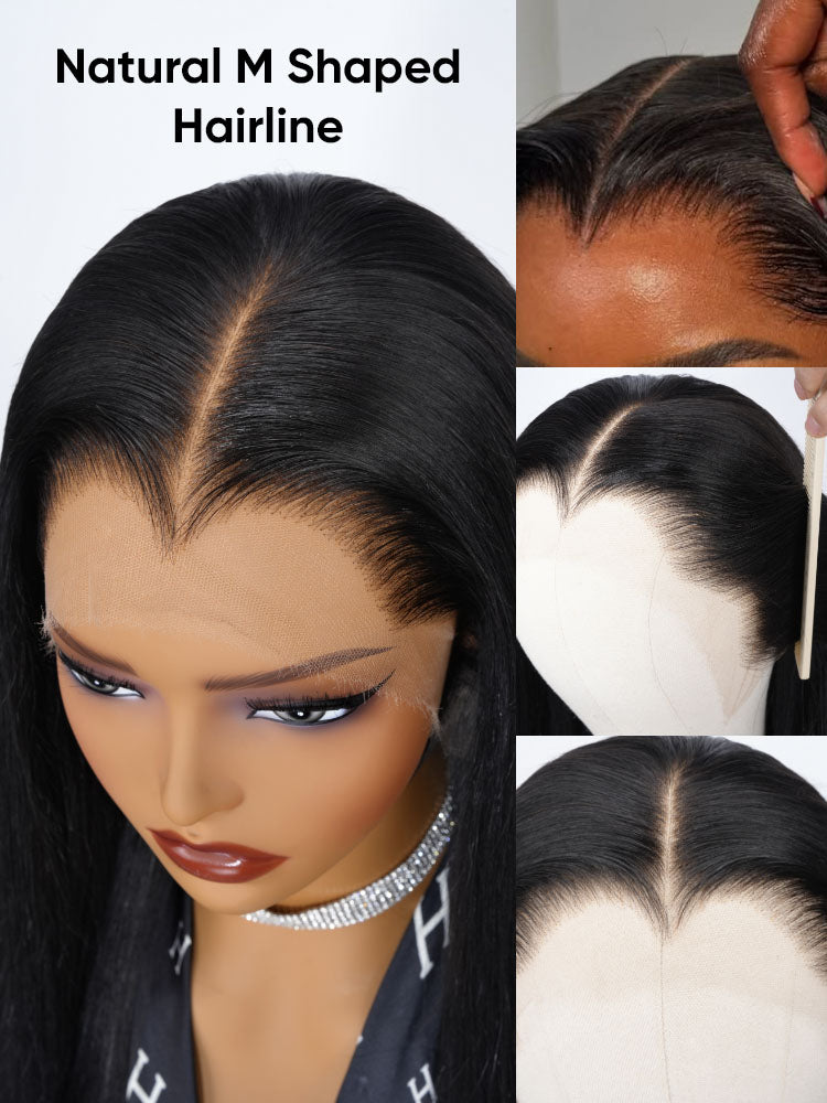 widows peak hairline