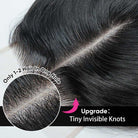 bundles with closure