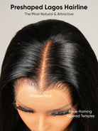 lagos hairline
