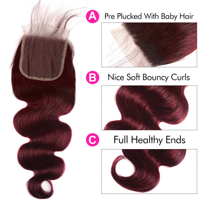 bundles with closure