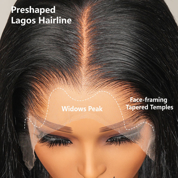 lagos hairline