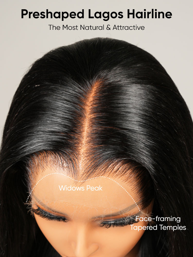 lagos hairline