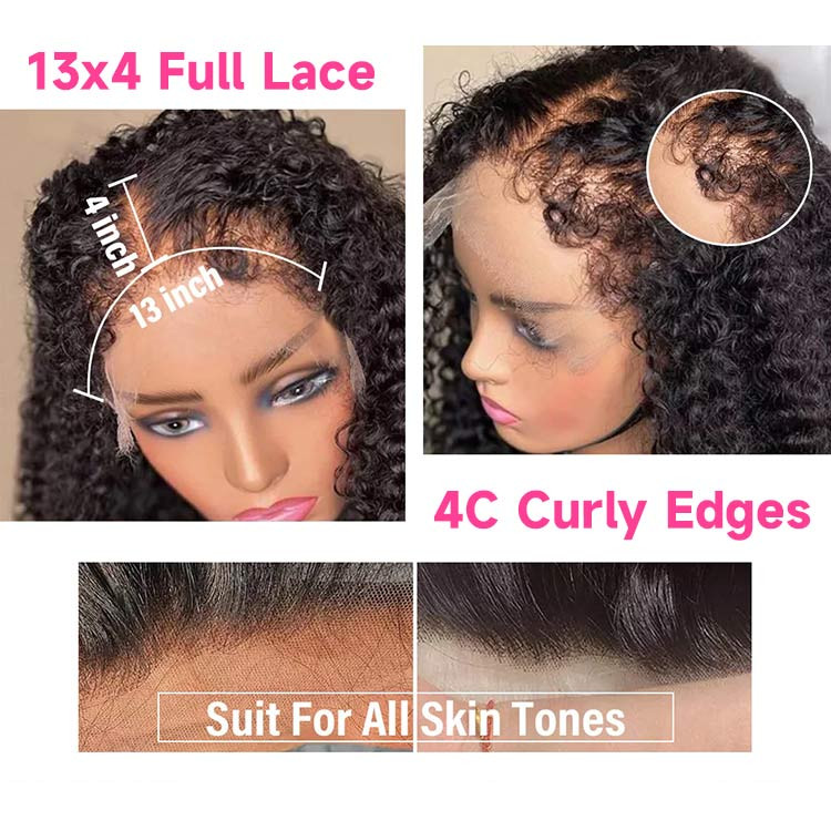 kinky hairline